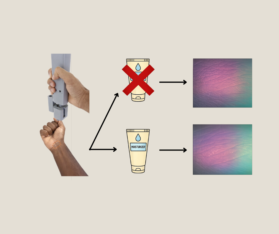 A New Way to Track Skin Health