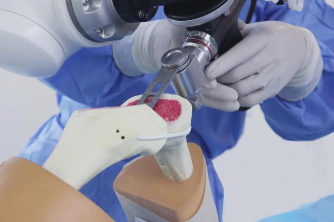 Domestic Strength Emerges: Shenzhen's Surgical Robot Achieves Top EU Certification