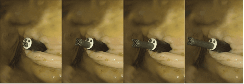 University of Leeds Develops Pressure-Free Growing Robots for Medical Applications