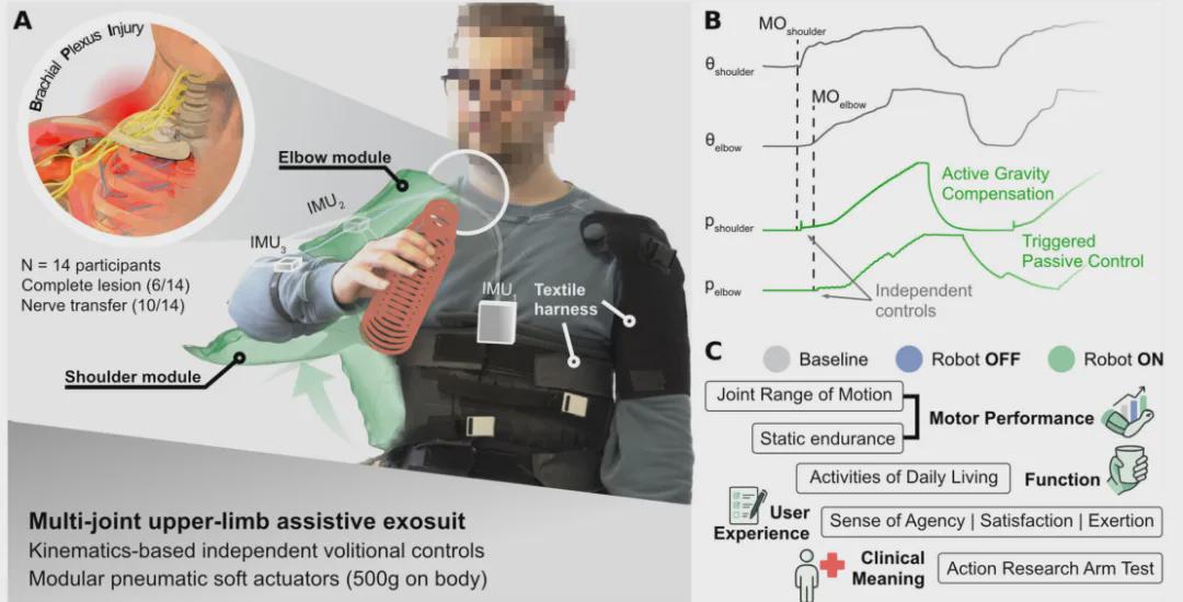 Soft Exosuit Increases Arm Mobility by 80-180% for Patients with Brachial Plexus Injuries