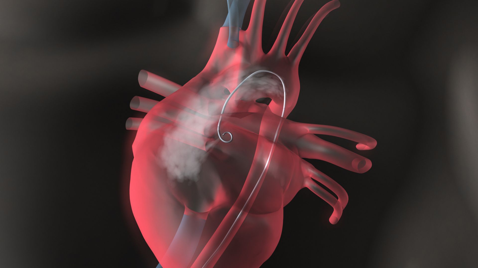 China Achieves World-First with AI-Driven Ultrasound Robot for Heart Surgery