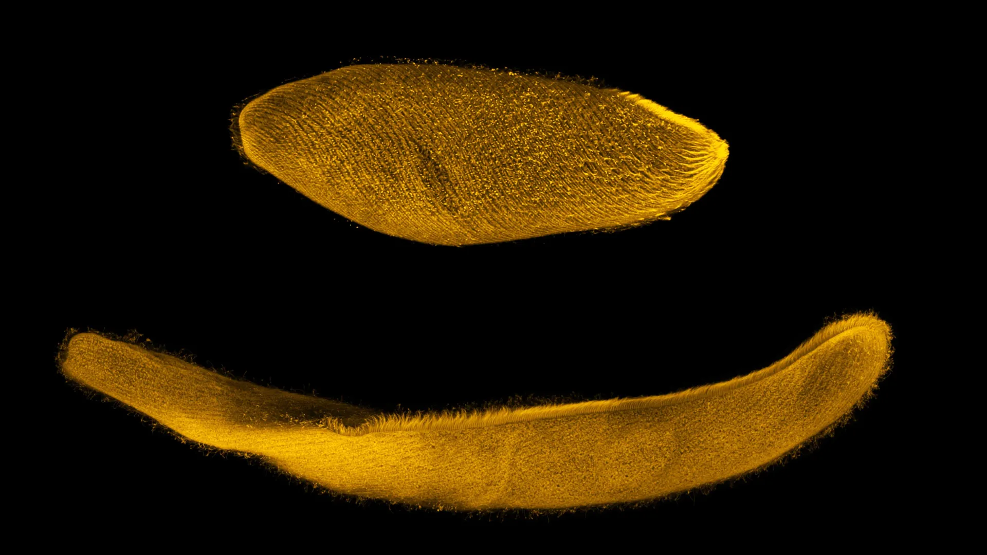 Spirostomum ambiguum Can Shrink to One Quarter of Its Size in Under Five Milliseconds