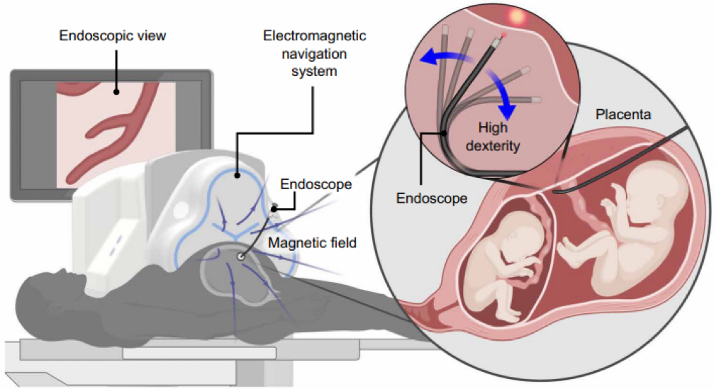 ETH Zurich Team Demonstrates Robotic System for Fetal Surgery in Sheep Using 3.2mm Endoscope
