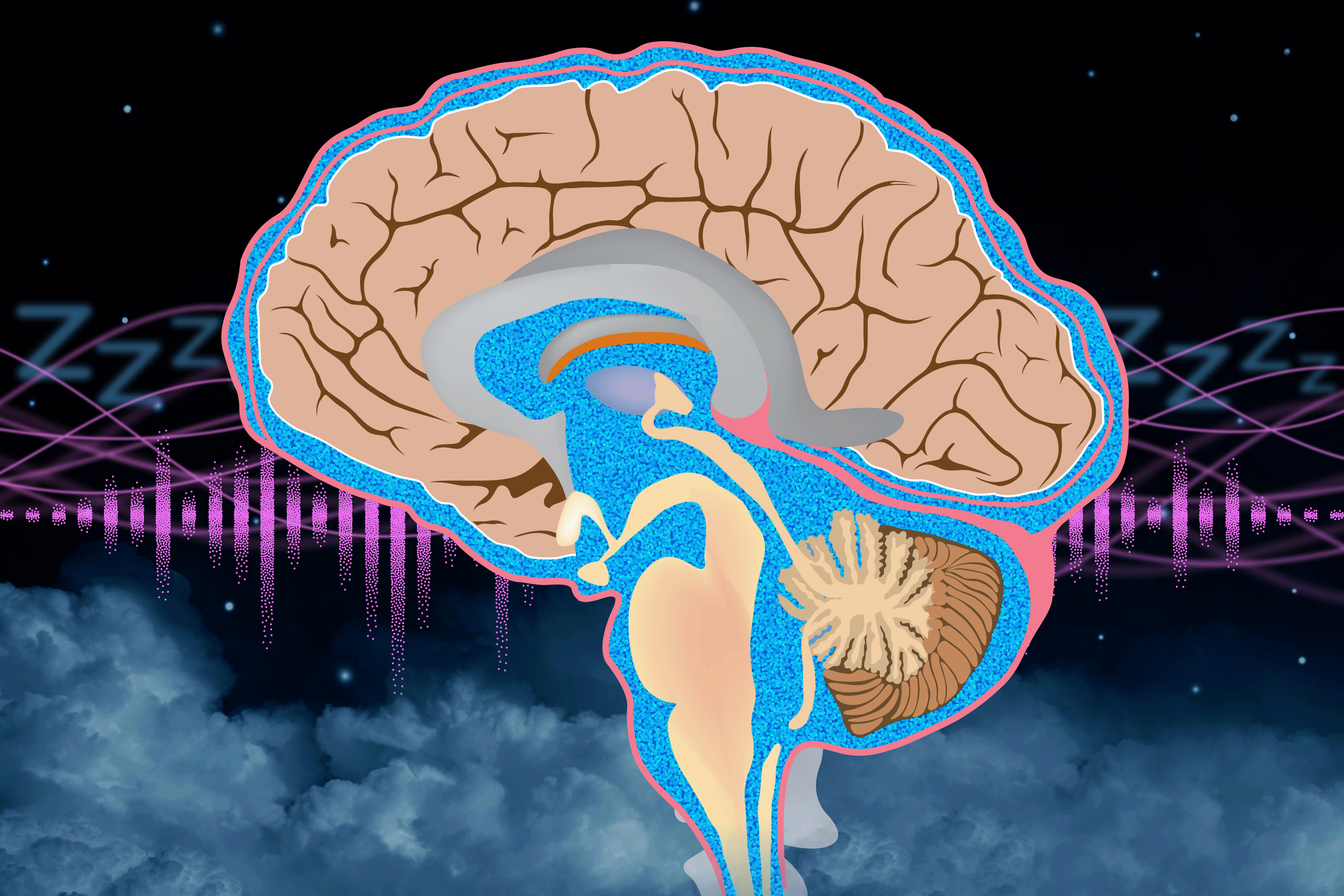MIT Researchers Enhance Cerebrospinal Fluid Flow During Sleep Using Pink Noise