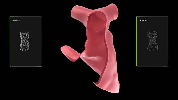 Major Children's Hospital Implements Open Source NVIDIA AI for Enhanced Cardiac Care