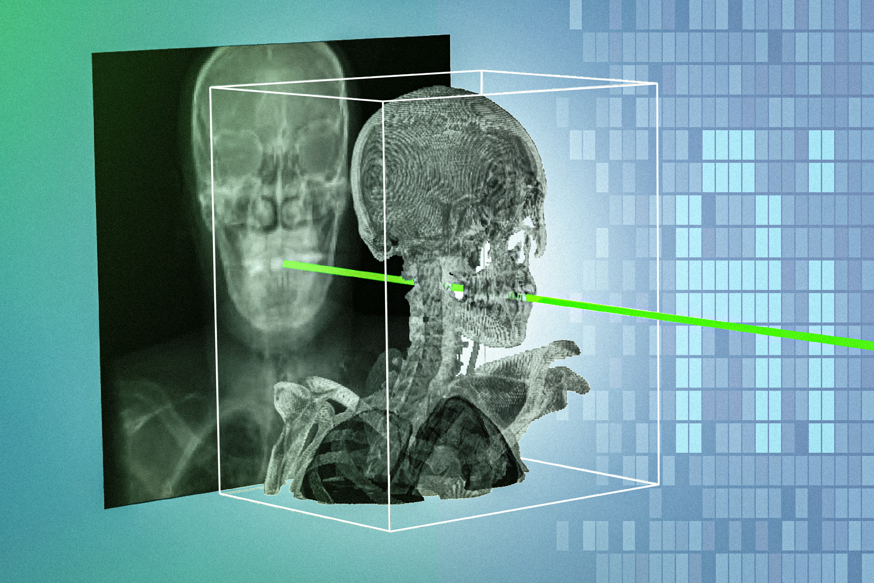 MIT Researchers Develop AI Technique to Enhance Safety and Precision in Minimally Invasive Surgeries