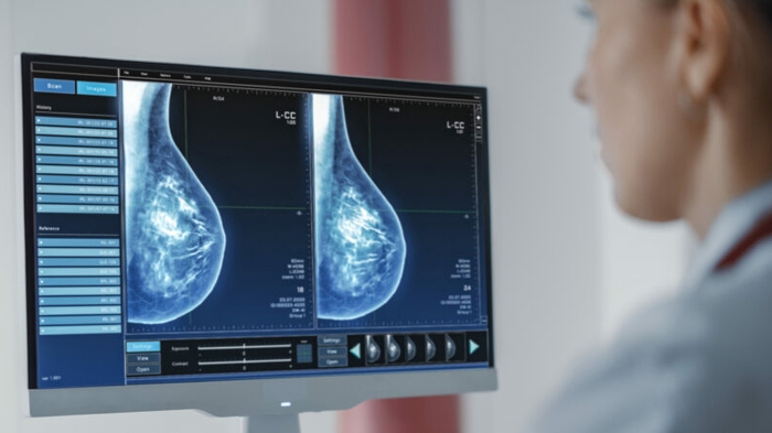 AI Innovations in Breast Cancer Care: Bridging Gaps from Screening to Treatment