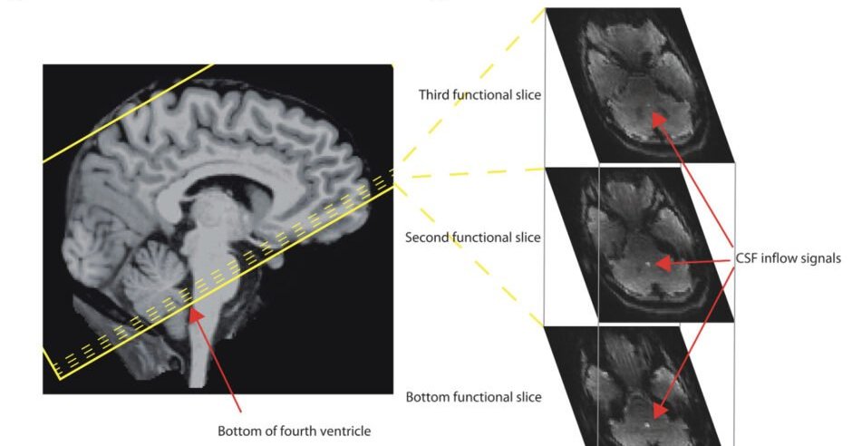 MIT Research Shows Pink Noise Enhances Cerebrospinal Fluid Flow During Sleep
